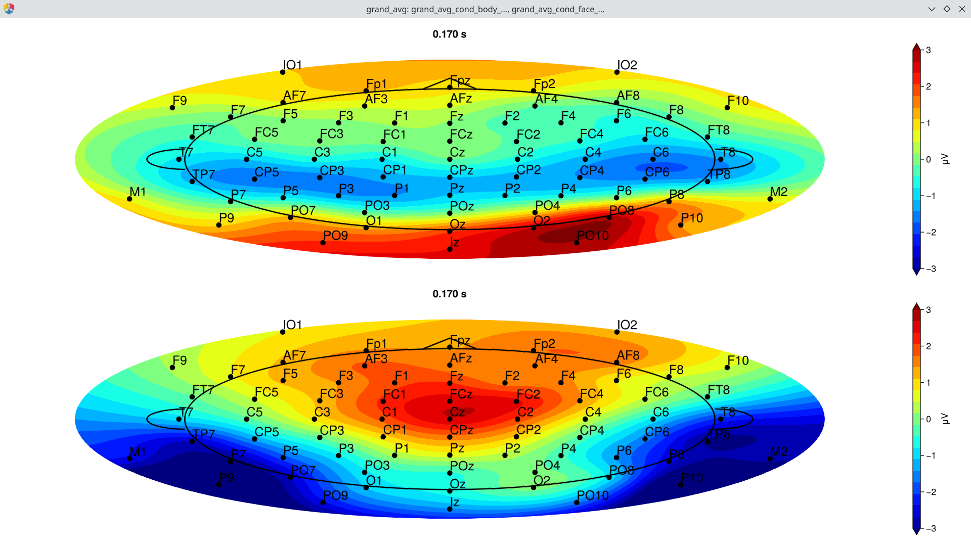 Topographic map at the N170 time window (~170 ms)