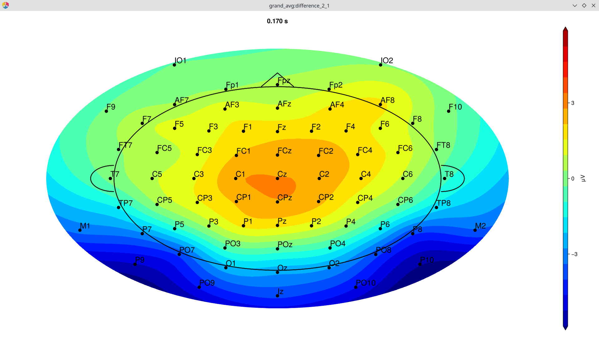 Difference wave topography at ~170 ms