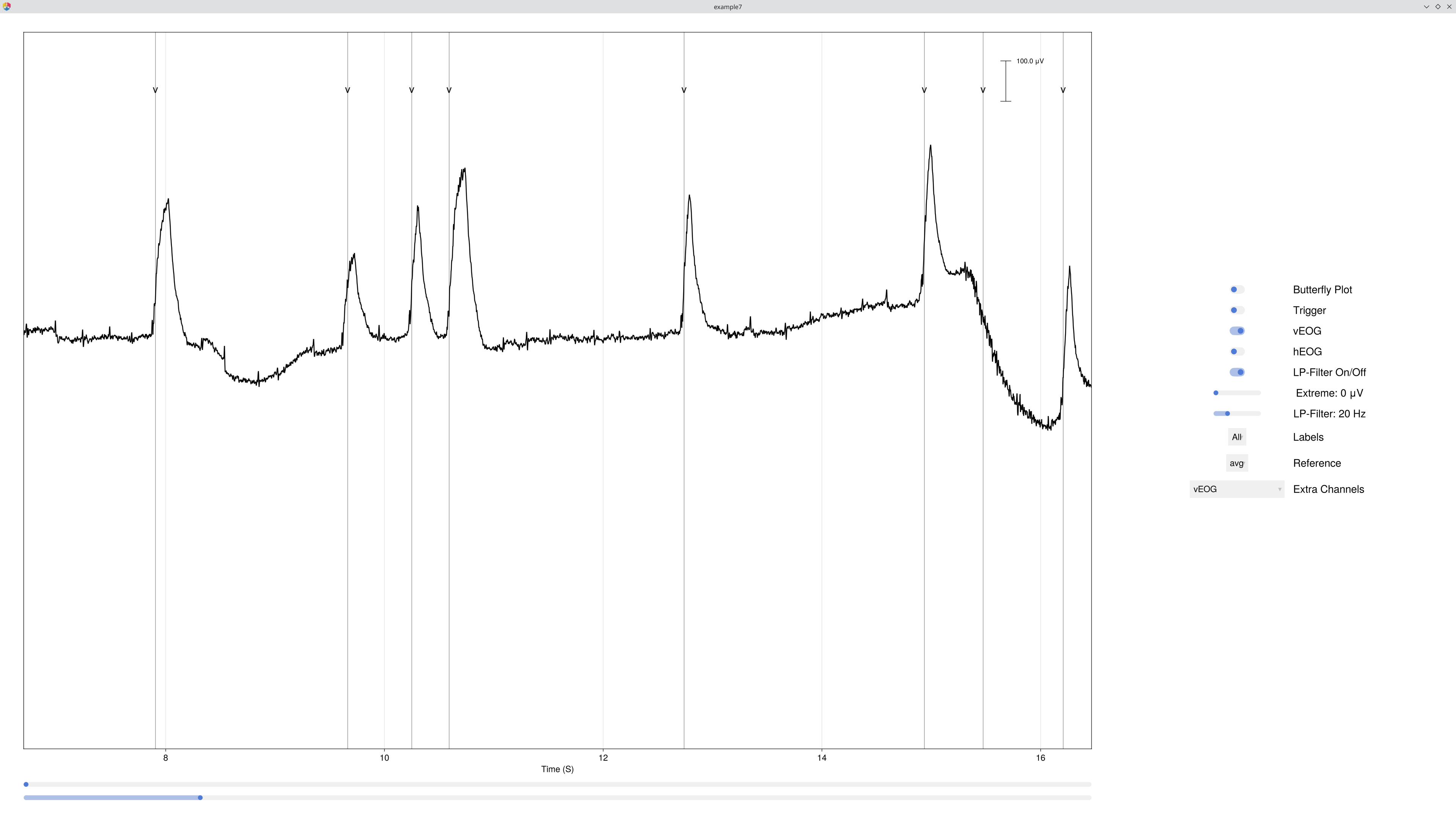 Databrowser showing vEOG channel with detected blink onsets highlighted
