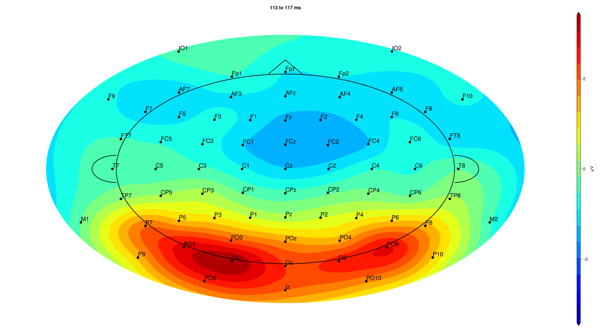 P1 topography (113–117 ms)