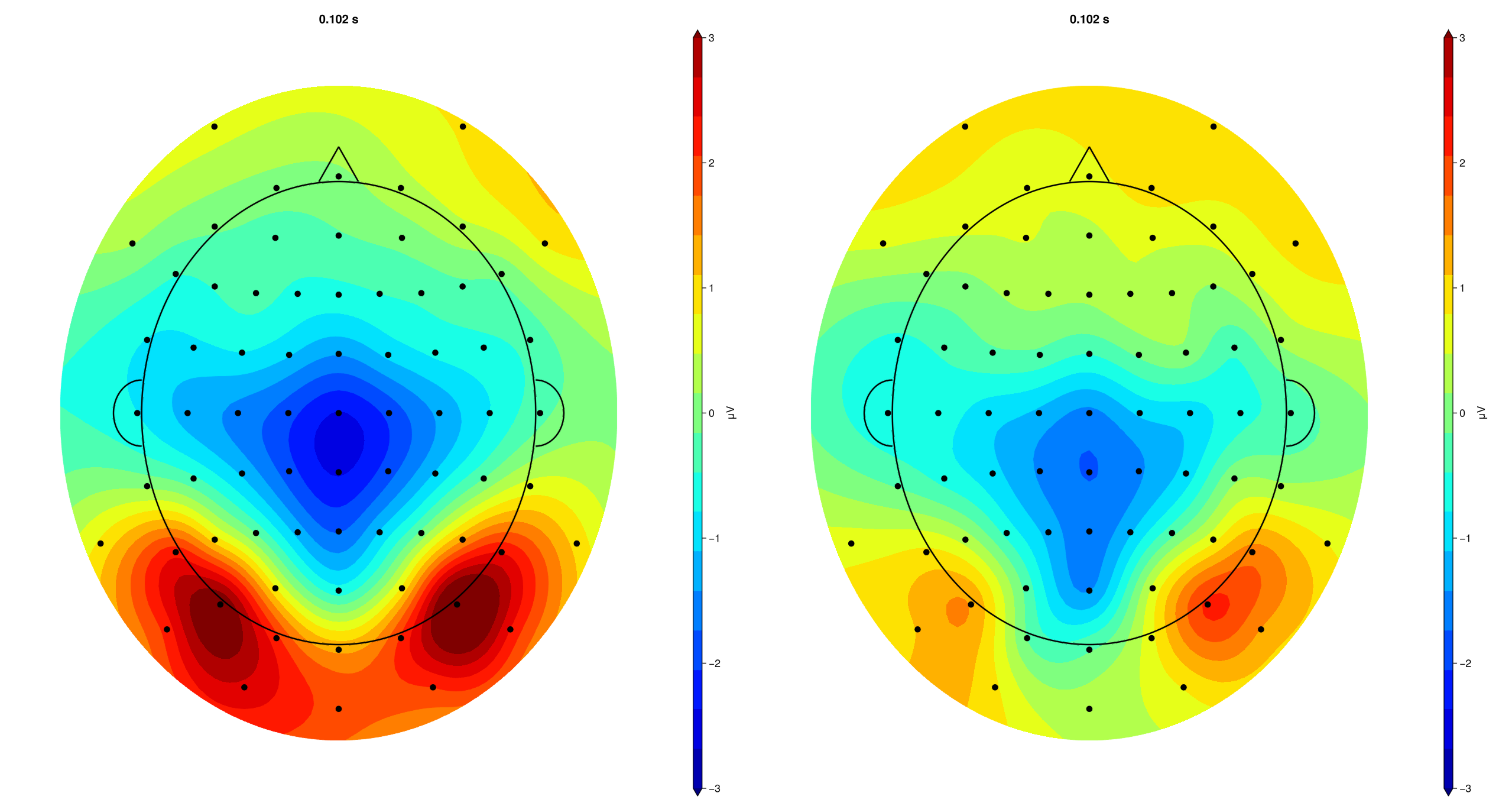 Condition-averaged Topography P1 (Valid vs Invalid)